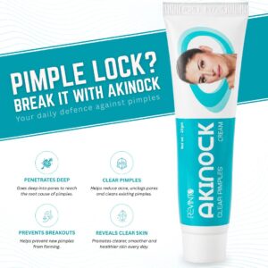 akinock-ayurvedic-anti-acne-cream